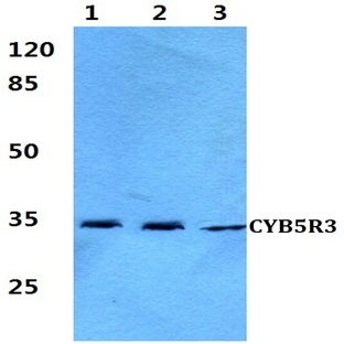 CYB5R3 (I169) pAb