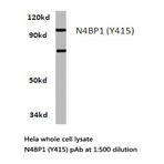 N4BP1 (Y415) pAb