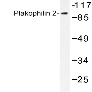 Plakophilin 2 (P663) pAb