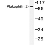 Plakophilin 2 (P663) pAb