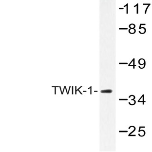 TWIK-1 (V322) pAb