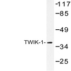 TWIK-1 (V322) pAb