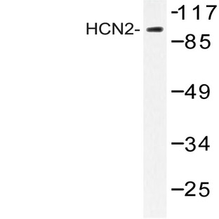 HCN2 (E521) pAb