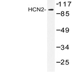 HCN2 (E521) pAb