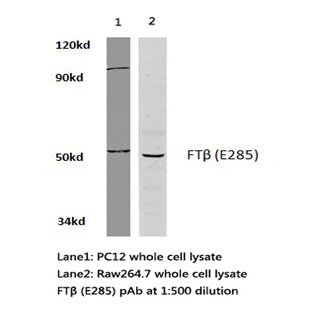 FT(beta) (E285) pAb