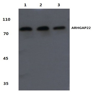 ARHGAP22 (R595) pAb