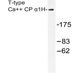 T-type Ca++ CP (alpha)1H (P492) pAb