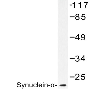 Synuclein-(alpha) (D119) pAb