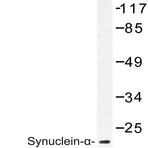 Synuclein-(alpha) (D119) pAb