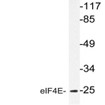 eIF4E (T203) pAb