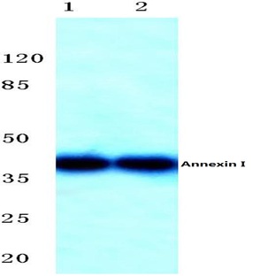 Annexin I (N146) pAb