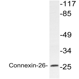 Connexin 26 (H94) pAb