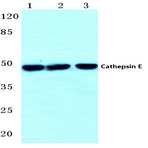 Cathepsin E (I292) pAb