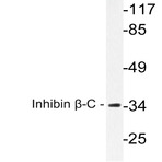 Inhibin (beta)-C (V129) pAb