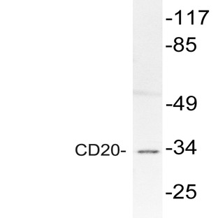 CD20 (L230) pAb