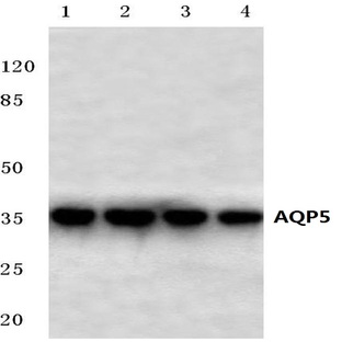 AQP5 (Y243) pAb