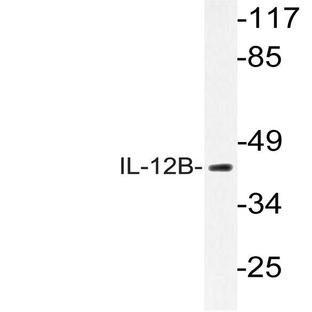IL-12B (V277) pAb