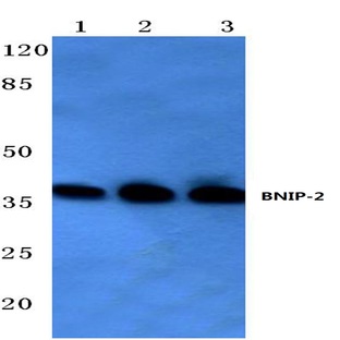 BNIP-2 (E122) pAb