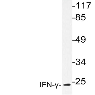 IFN-(gamma) (Q69) pAb