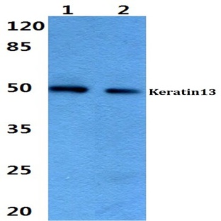 Cytokeratin 13 (E282) pAb