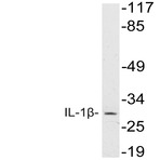 IL-1(beta) (F162) pAb