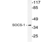 SOCS-1 (V98) pAb