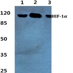 HIF-1(alpha) (K377) pAb