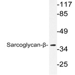 Sarcoglycan-(beta) (V136) pAb