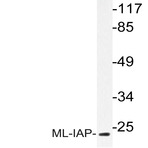 ML-IAP (E211) pAb