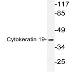 Cytokeratin 19 (L349) pAb