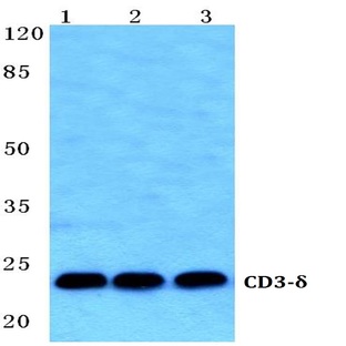 CD3-(delta) (T56) pAb