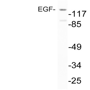 EGF (R709) pAb