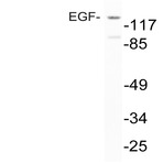 EGF (R709) pAb