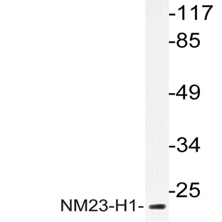 NM23-H1 (Y52) pAb