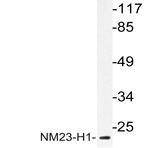 NM23-H1 (Y52) pAb