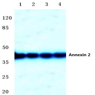 Annexin 2 (N137) pAb