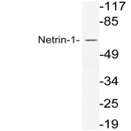 Netrin-1 (Q533) pAb