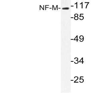 NF-M (K591) pAb