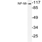 NF-M (K591) pAb