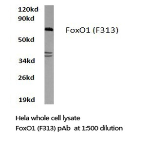 FKHR/FoxO1 (F313) pAb