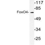 FoxO4 (P191) pAb