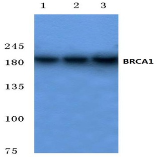 BRCA1 (P982) pAb