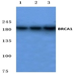 BRCA1 (P982) pAb