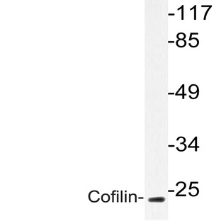 Cofilin (M1) pAb