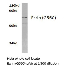 Ezrin (G560) pAb