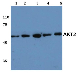 AKT2 (T468) pAb