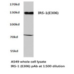 IRS-1 (E306) pAb