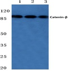 Catenin-(beta) (Q27) pAb