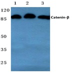 Catenin-(beta) (Y30) pAb