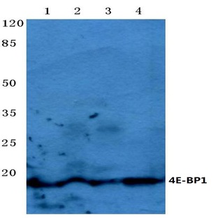 4E-BP1 (P30) pAb